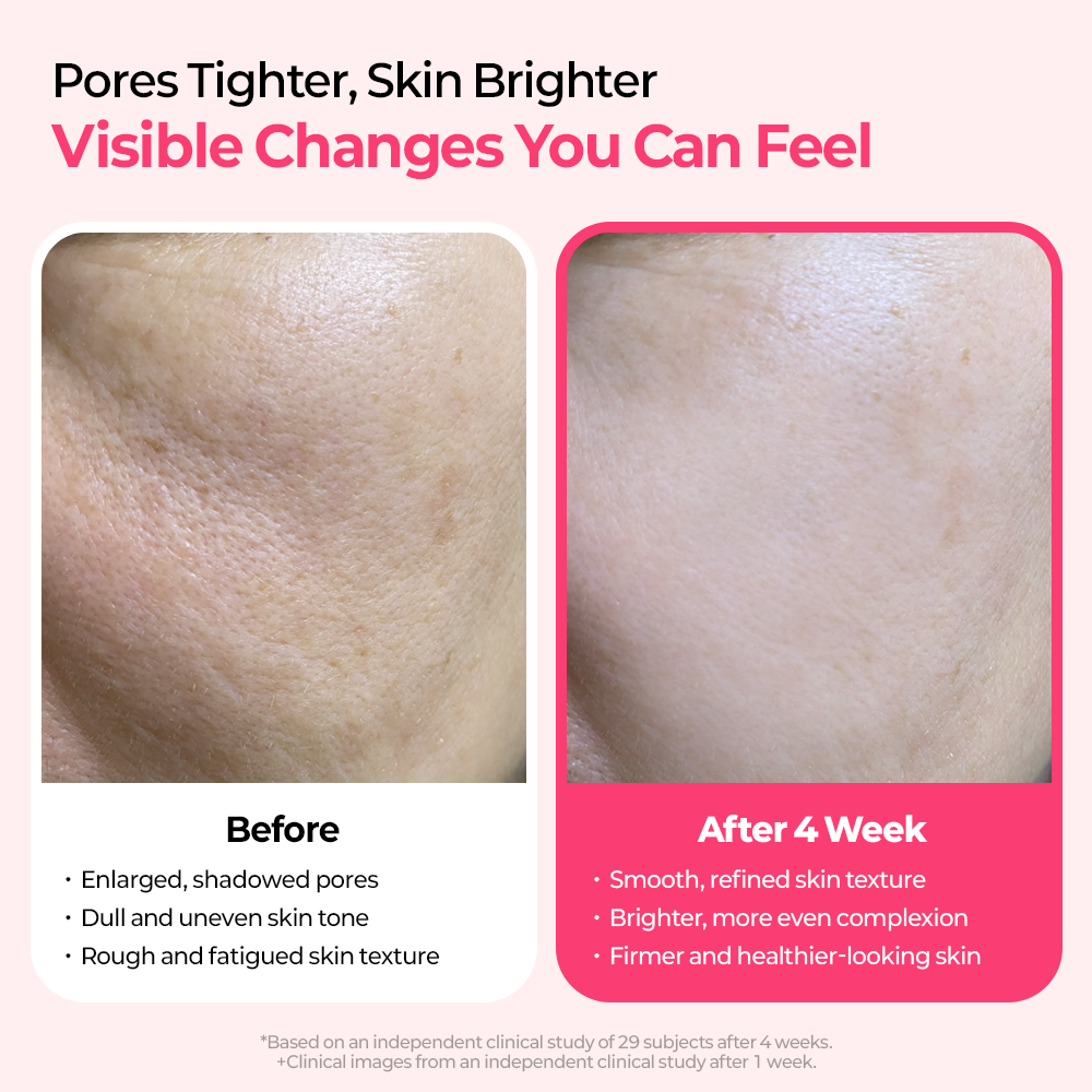 Cemenrete Cyano Pink Spicule Line - image 8