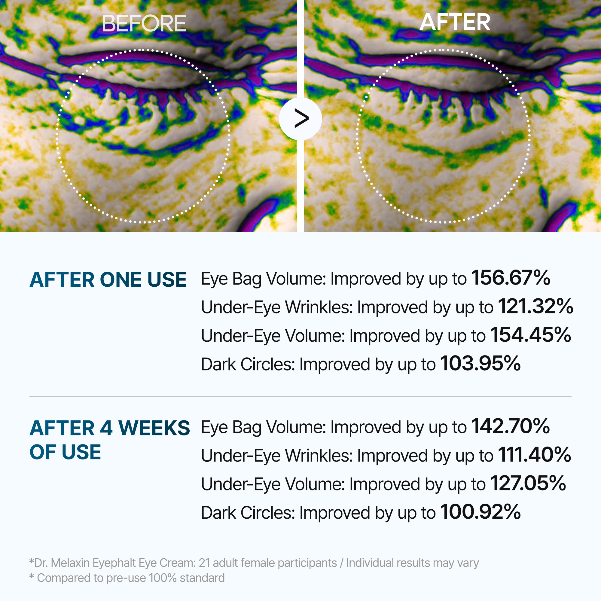 Eyephalt eyebag cream - image 8